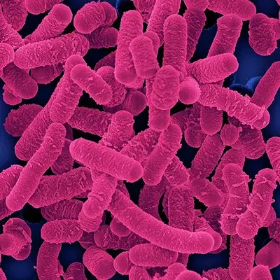 Lactobacillus Salivarius strain supporting gum and breath health
